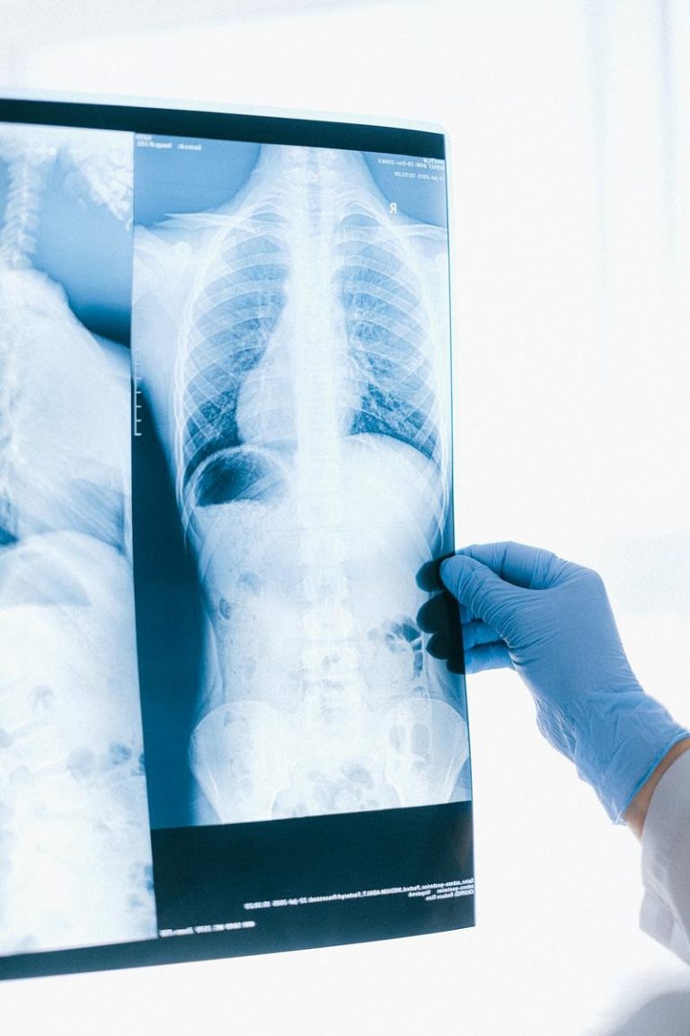 Jak wygląda badanie USG bioderek u dzieci krok po kroku – poradnik dla rodziców